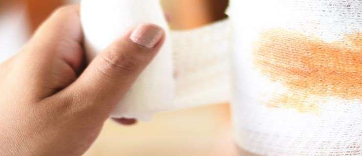 First Aid – Soft Tissue Injuries